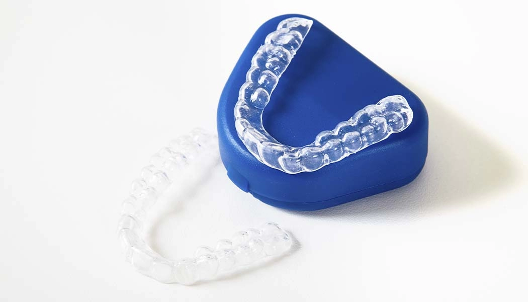 фото:Зубная каппа из силикона::Силиконовая каппа от скрежета зубов